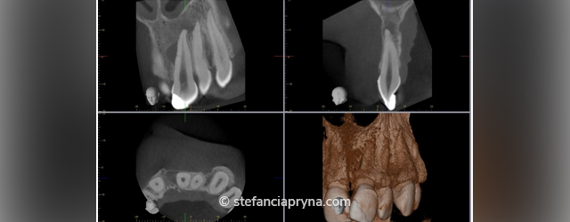 Case 11