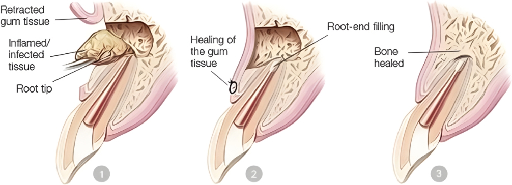 microscopic-surgery